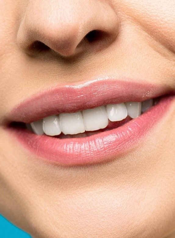 Sbiancamento dentale: immagine illustrativa